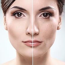 500ml (16.9oz) ORGANIC GOLDEN CASTOR Oil, 100% Pure Certified For Hair, Beard, Moisturizes, Softens, Nourishes Skin, Hair and Nails, Made in Canada, No Chemicals Cruelty Free Hexane free (500ml) …free and fast delivery.